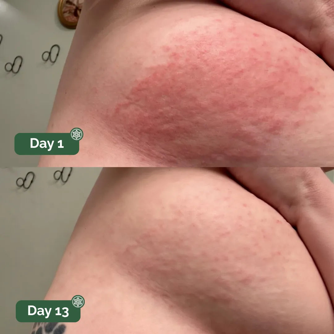 Real customer before and after result 2