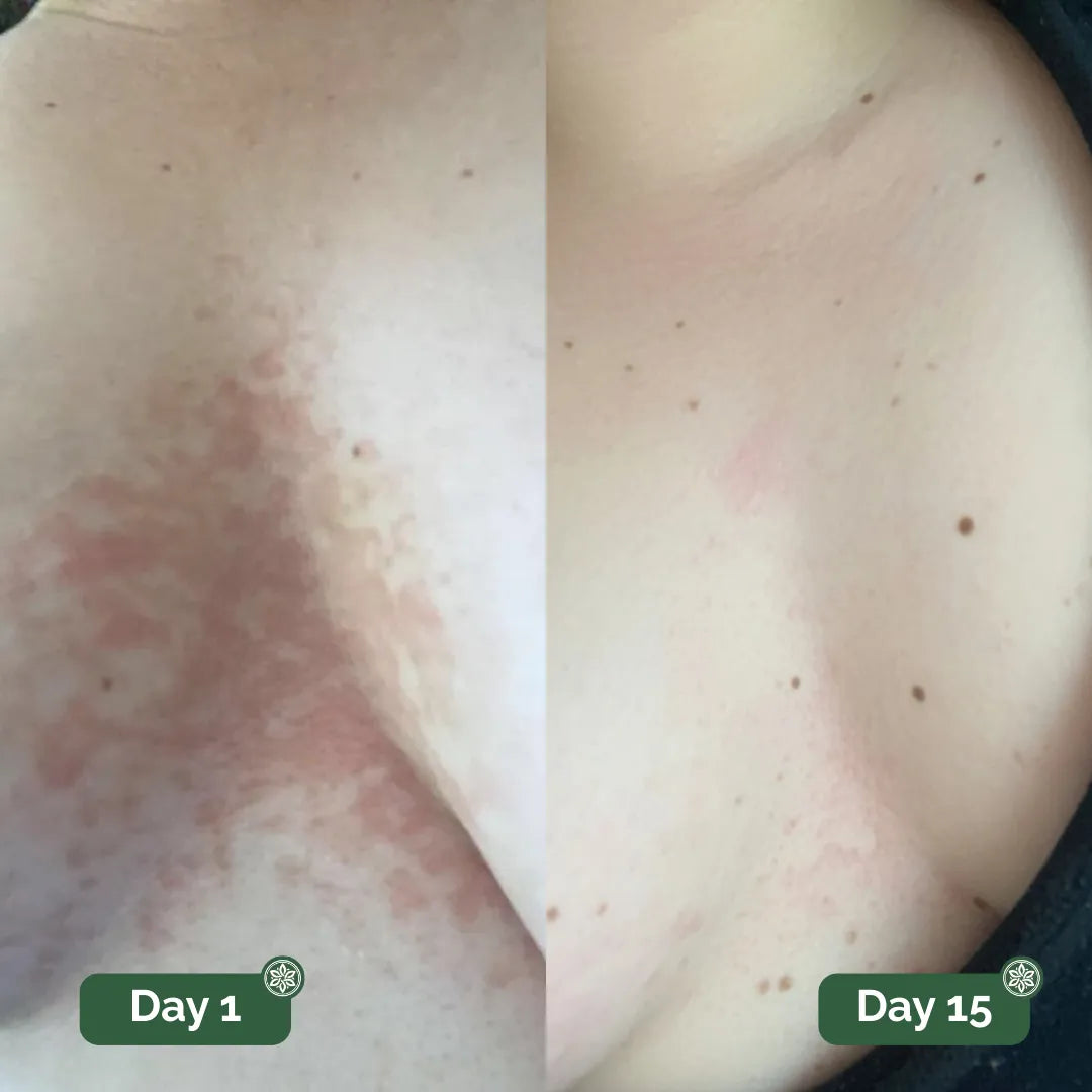 Real customer before and after result 1