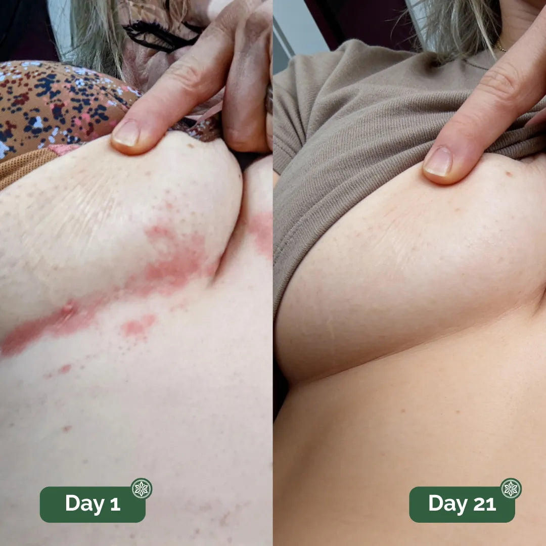 Real customer before and after result 3